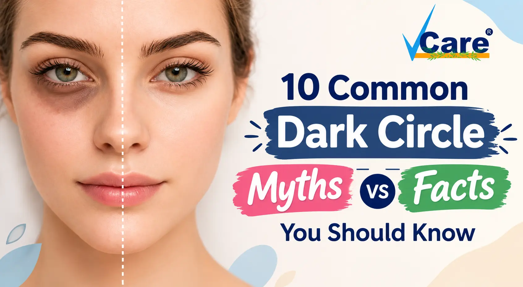10 Common Dark Circle Myths vs Facts You Should Know