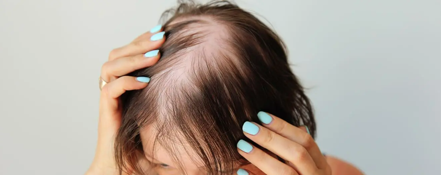 hair disorder