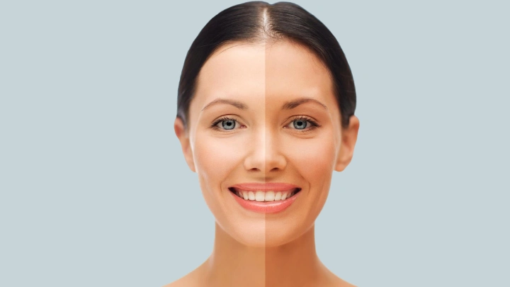 skin whitening treatment