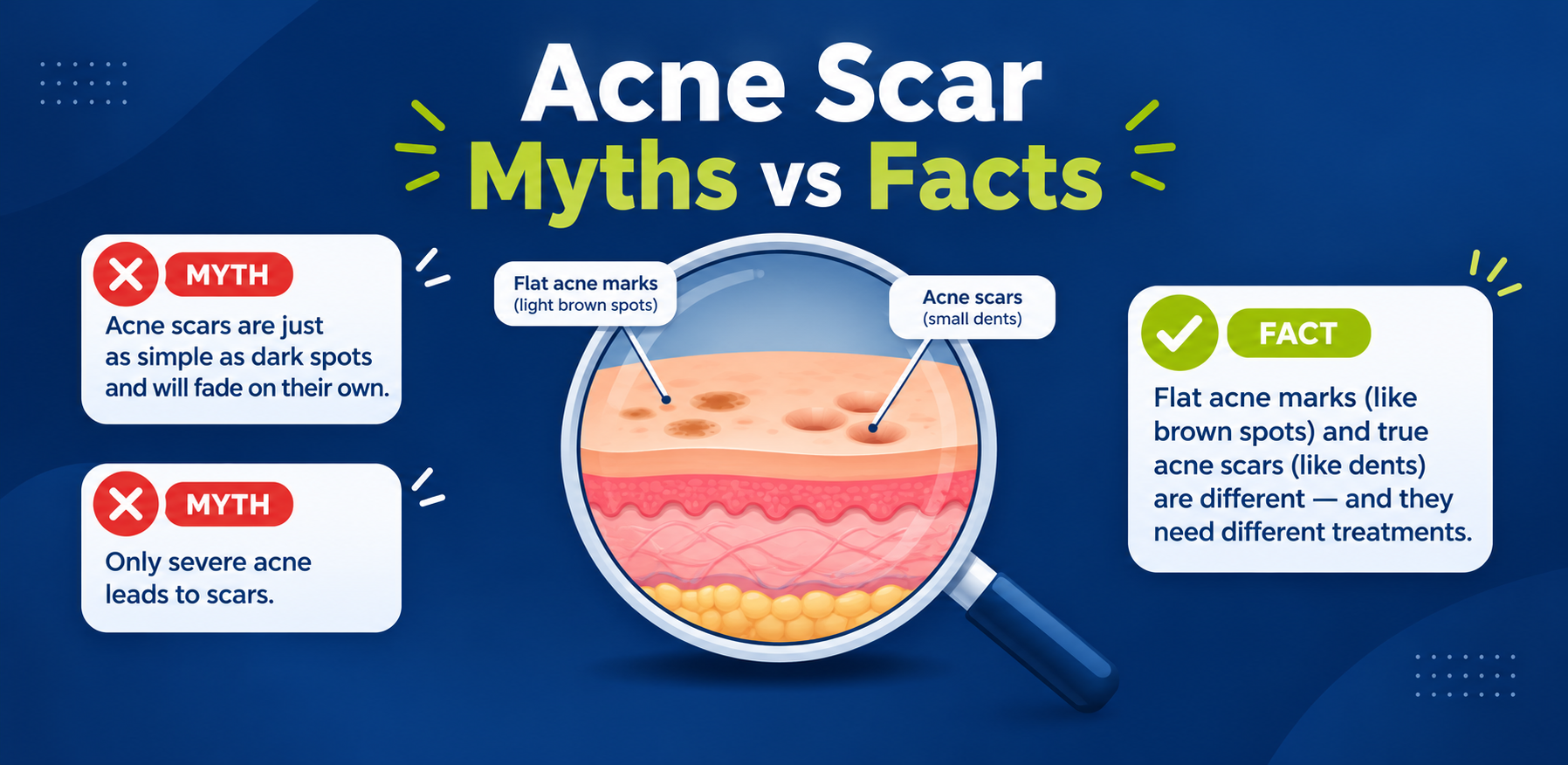 Acne scar myths vs facts