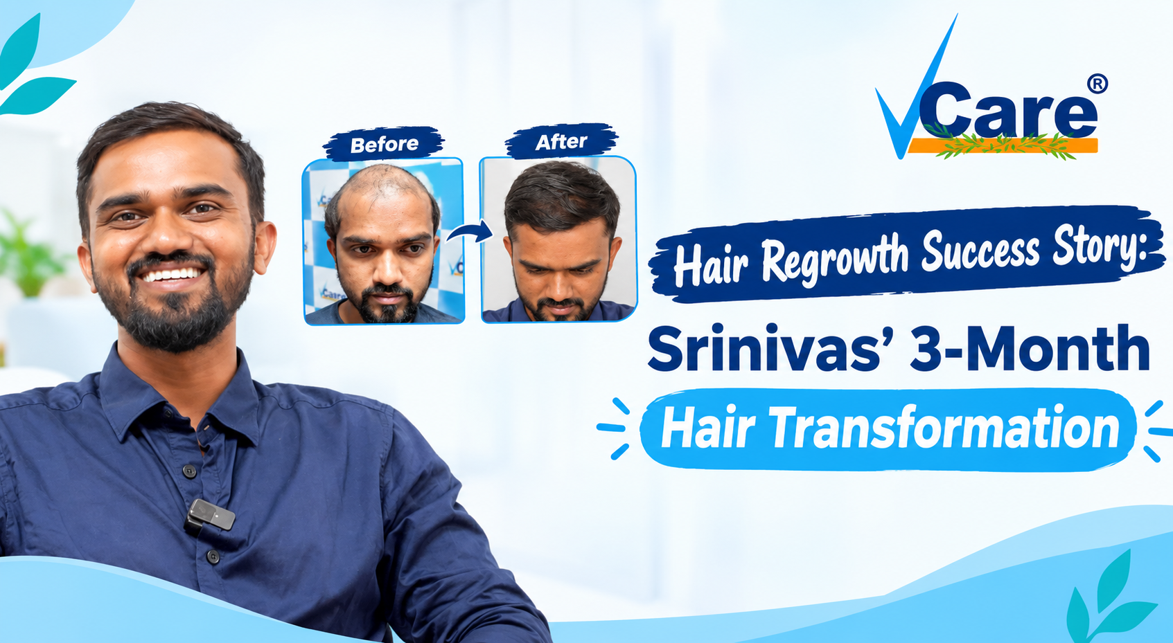 Hair Regrowth Success Story: Srinivas' 3-Month Hair Transformation