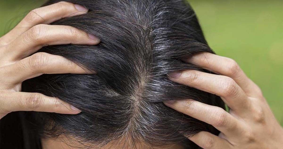 grey-hair-treatment-chennai