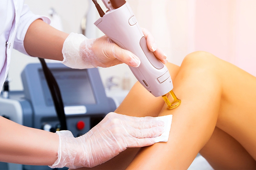 Laser Hair Removal in Bangalore: Procedure, Benefits & Cost (2026)