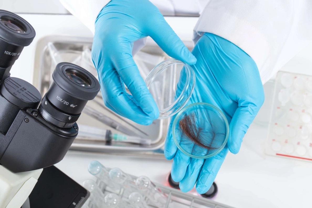 Hair Mineral Analysis: How It Helps Identify the Root Causes of Hair Loss