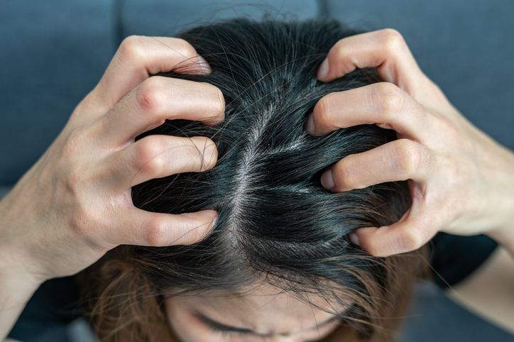 Scalp Disorders: Common Types, Symptoms, Causes & Scalp Care Tips