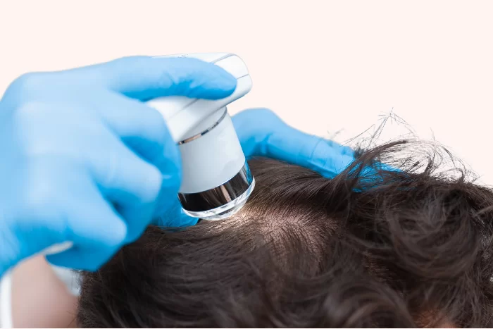 TrichoScan Hair Analysis: A Complete Guide to Hair Fall Diagnosis
